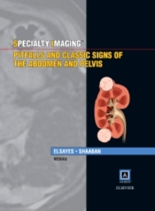 Specialty Imaging: Pitfalls and Classic Signs of the Abdomen and Pelvis E-Book : Specialty Imaging: Pitfalls and Classic Signs of the Abdomen and Pelvis E-Book