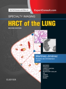 Specialty Imaging: HRCT of the Lung : Specialty Imaging: HRCT of the Lung E-Book