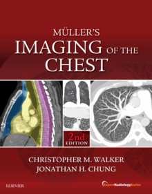 Muller's Imaging of the Chest E-Book : Expert Radiology Series