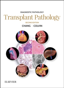 Diagnostic Pathology: Transplant Pathology : Diagnostic Pathology: Transplant Pathology E-Book