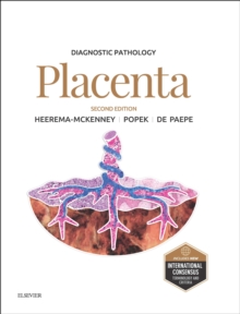 Diagnostic Pathology: Placenta E-Book : Diagnostic Pathology: Placenta E-Book