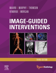 Image-Guided Interventions E-Book : Expert Radiology Series