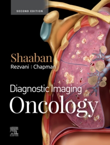 Diagnostic Imaging: Oncology : Diagnostic Imaging: Oncology E-Book