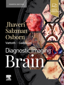 Diagnostic Imaging: Brain E-Book : Diagnostic Imaging: Brain E-Book