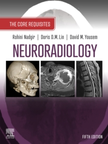Neuroradiology: The Requisites E-Book : The Core Requisites
