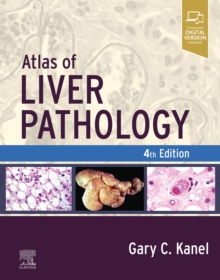 Atlas of Liver Pathology - E-Book