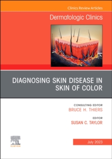 Diagnosing Skin Disease in Skin of Color, An Issue of Dermatologic Clinics : Volume 41-3