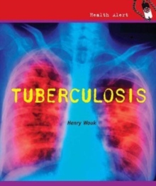 Tuberculosis