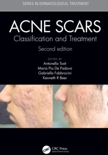 Acne Scars : Classification and Treatment, Second Edition