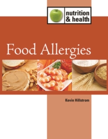 Food Allergies