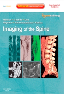 Imaging of the Spine E-Book : Expert Radiology Series