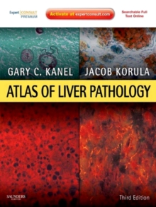 Atlas of Liver Pathology E-Book : Expert Consult - Online and Print