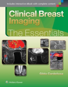 Clinical Breast Imaging: The Essentials : The Essentials
