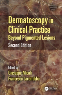 Dermatoscopy in Clinical Practice : Beyond Pigmented Lesions