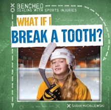 What If I Break a Tooth?