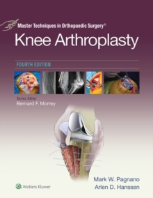 Master Techniques in Orthopedic Surgery: Knee Arthroplasty