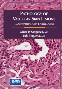 Pathology of Vascular Skin Lesions : Clinicopathologic Correlations