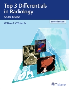 Top 3 Differentials in Radiology : A Case Review