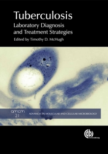 Tuberculosis : Laboratory Diagnosis and Treatment Strategies