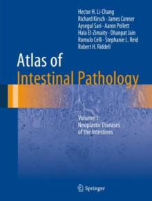 Atlas of Intestinal Pathology : Volume 1: Neoplastic Diseases of the Intestines
