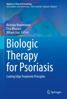 Biologic Therapy for Psoriasis : Cutting Edge Treatment Principles