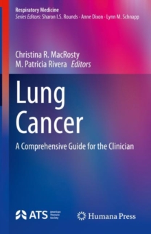 Lung Cancer : A Comprehensive Guide for the Clinician