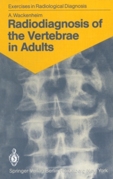 Radiodiagnosis of the Vertebrae in Adults : 125 Exercises for Students and Practitioners