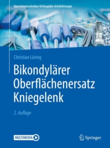 Bikondylarer Oberflachenersatz Kniegelenk