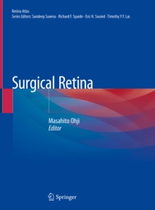 Surgical Retina