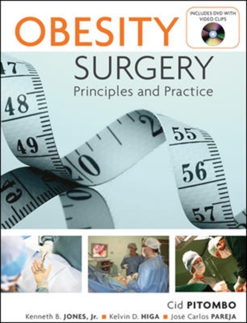 Obesity Surgery: Principles and Practice, EPUB eBook