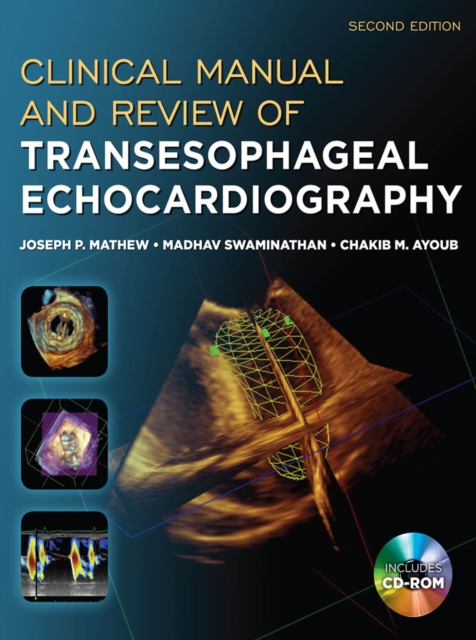 Clinical Manual and Review of Transesophageal Echocardiography, Second Edition, EPUB eBook