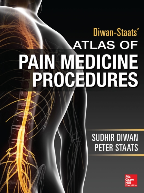Atlas of Pain Medicine Procedures, EPUB eBook