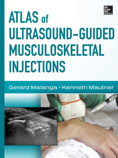 Atlas of Ultrasound-Guided Musculoskeletal Injections, EPUB eBook