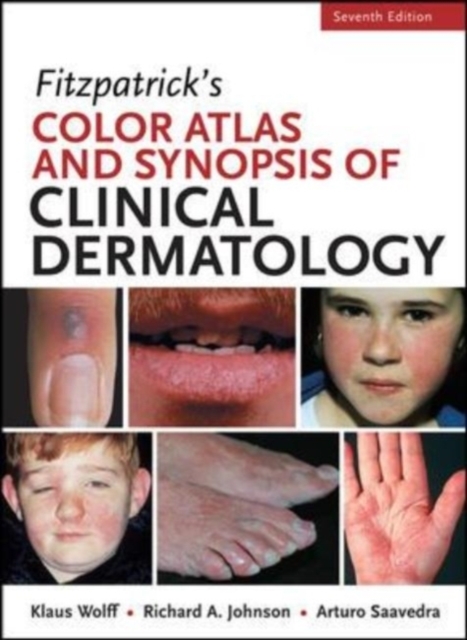 Fitzpatrick's Color Atlas and Synopsis of Clinical Dermatology, Seventh Edition, EPUB eBook