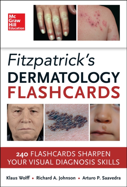 Fitzpatricks Dermatology Flash Cards, EPUB eBook