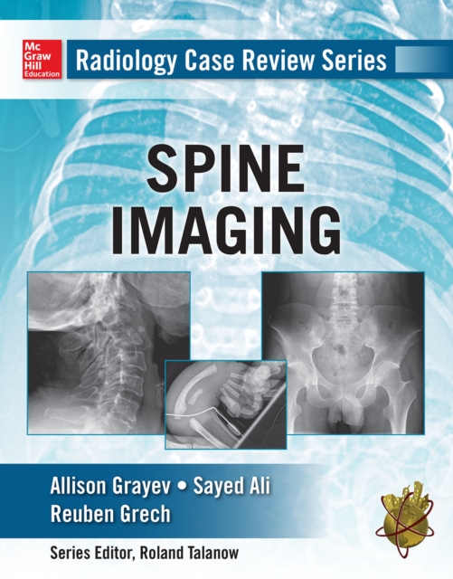 Radiology Case Review Series: Spine, EPUB eBook