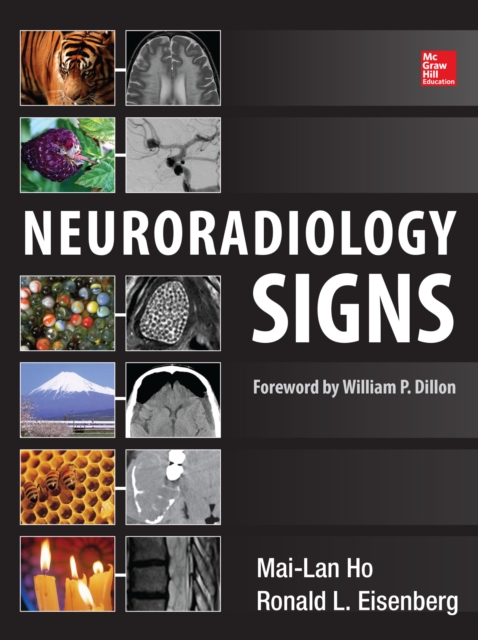 Neuroradiology Signs, EPUB eBook