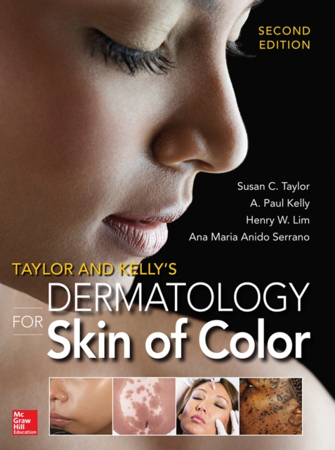 Taylor and Kelly's Dermatology for Skin of Color 2/E, EPUB eBook