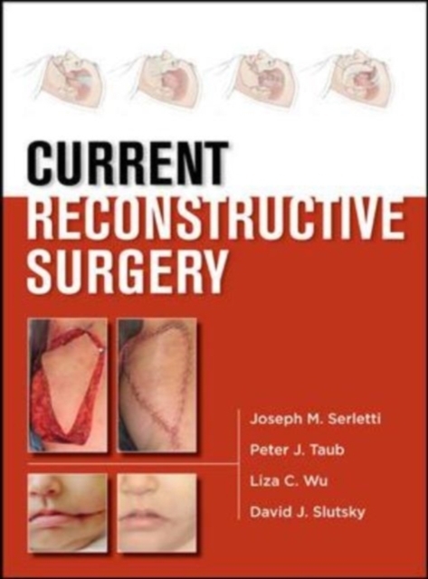 Current Reconstructive Surgery, EPUB eBook