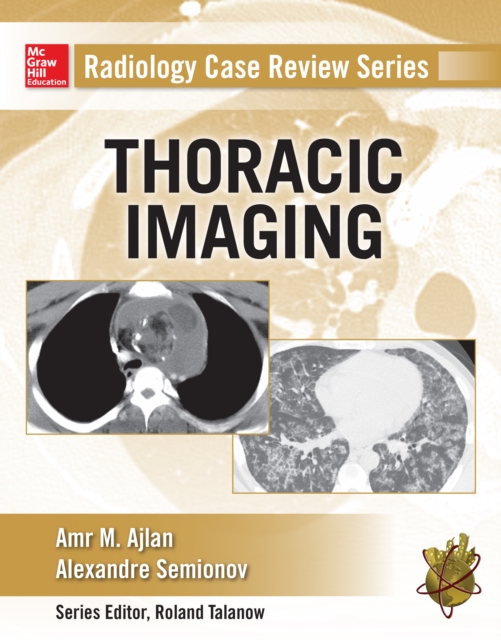 Radiology Case Review Series: Thoracic Imaging, EPUB eBook