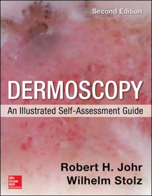 Dermoscopy: An Illustrated Self-Assessment Guide, 2/e, Paperback / softback Book