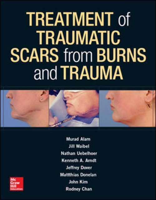 Treatment of Scars from Burns and Trauma, Hardback Book