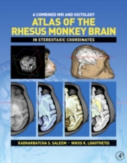 A Combined MRI and Histology Atlas of the Rhesus Monkey Brain in Stereotaxic Coordinates, PDF eBook