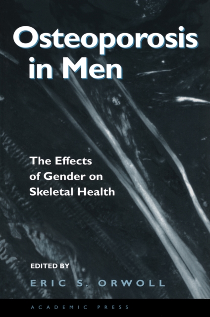 Osteoporosis in Men : The Effects of Gender on Skeletal Health, PDF eBook