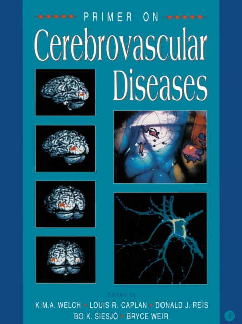 Primer on Cerebrovascular Diseases, PDF eBook