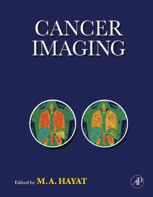 Cancer Imaging : Instrumentation and Applications, PDF eBook