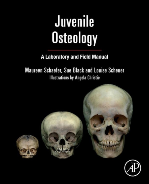 Juvenile Osteology : A Laboratory and Field Manual, EPUB eBook