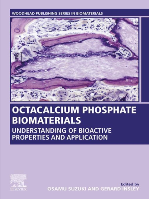Octacalcium Phosphate Biomaterials : Understanding of Bioactive Properties and Application, EPUB eBook