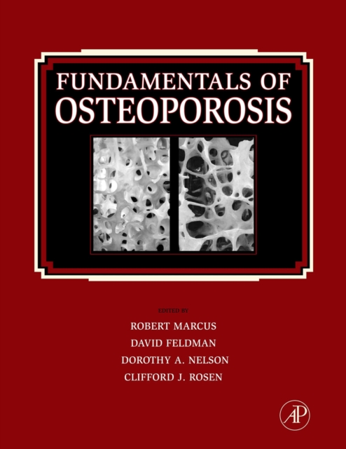 Fundamentals of Osteoporosis, EPUB eBook