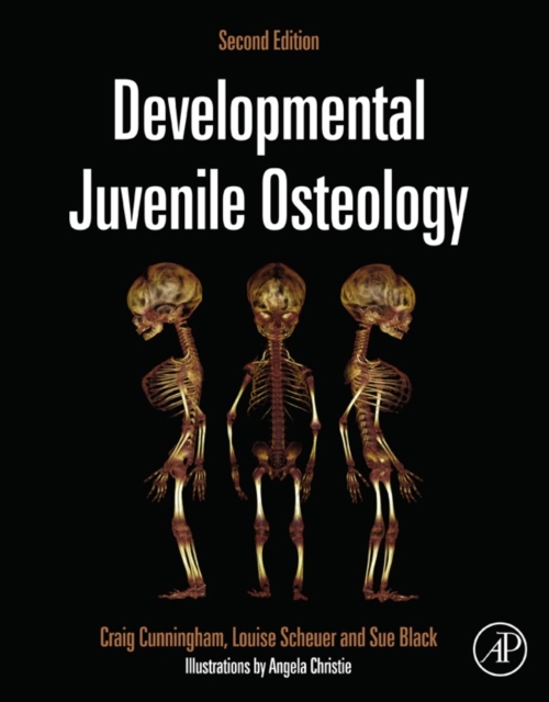 Developmental Juvenile Osteology, EPUB eBook